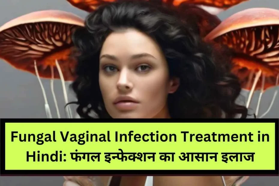 Fungal Vaginal Infection Treatment in Hindi